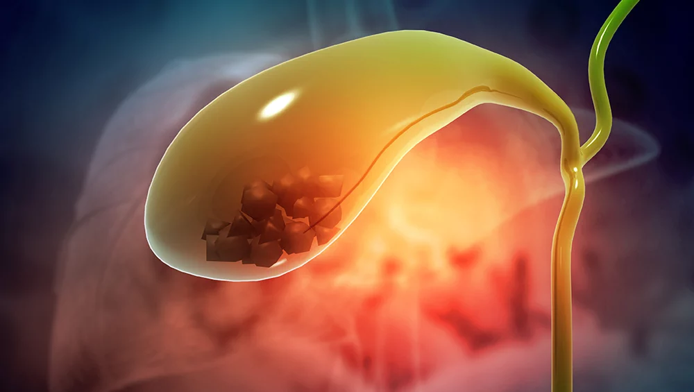 Problems with the gallbladder. When should I go to the doctor?