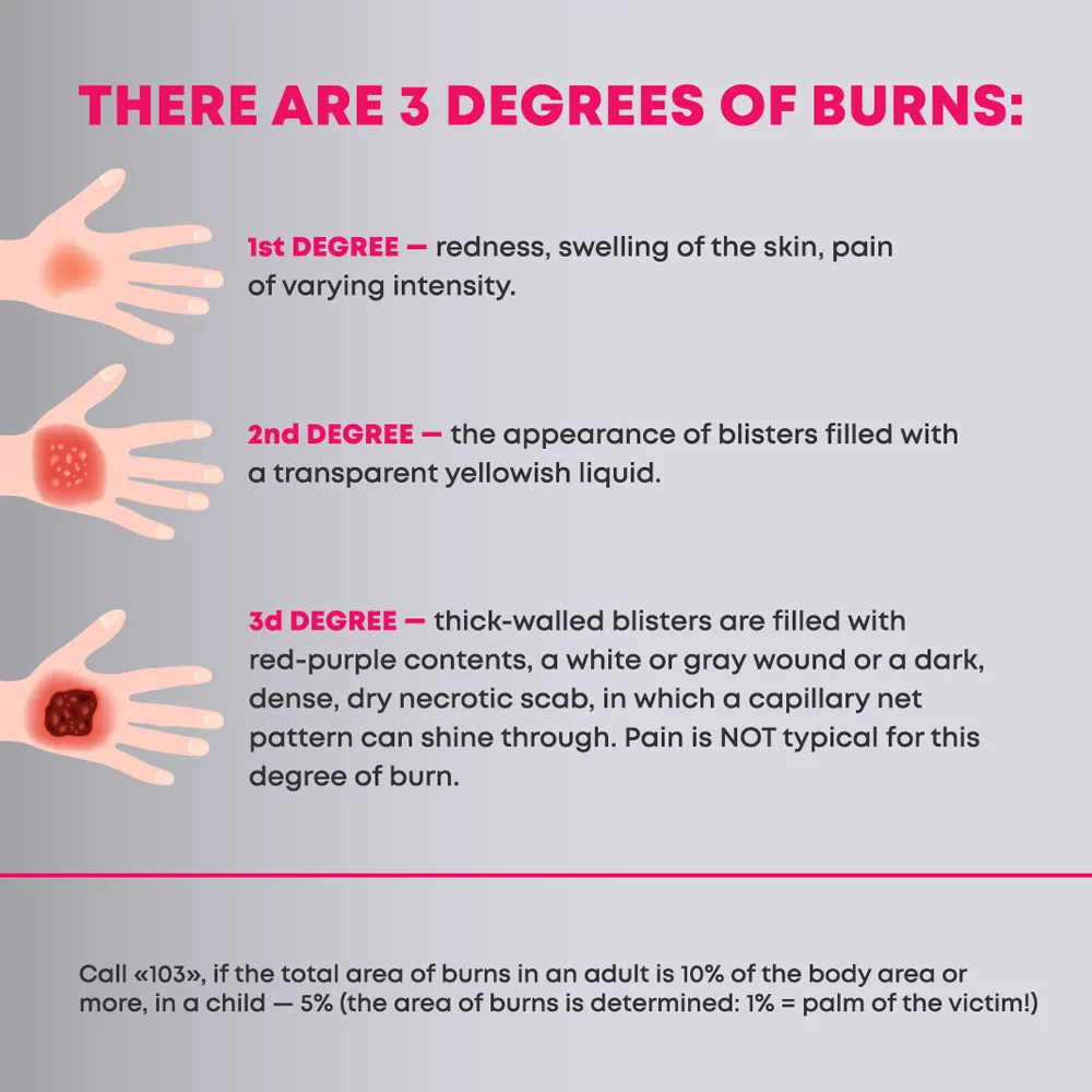 What are burns, and what are their degrees?