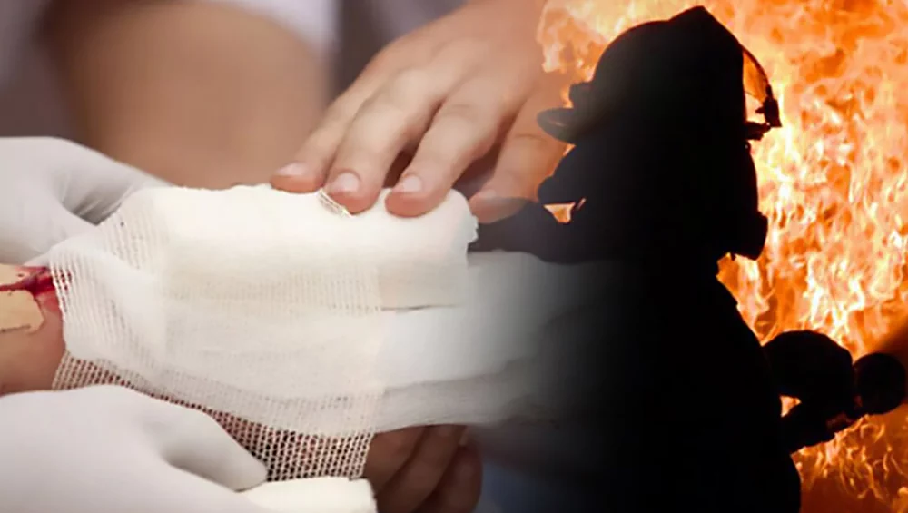 First aid for various types of burns: what to do at home