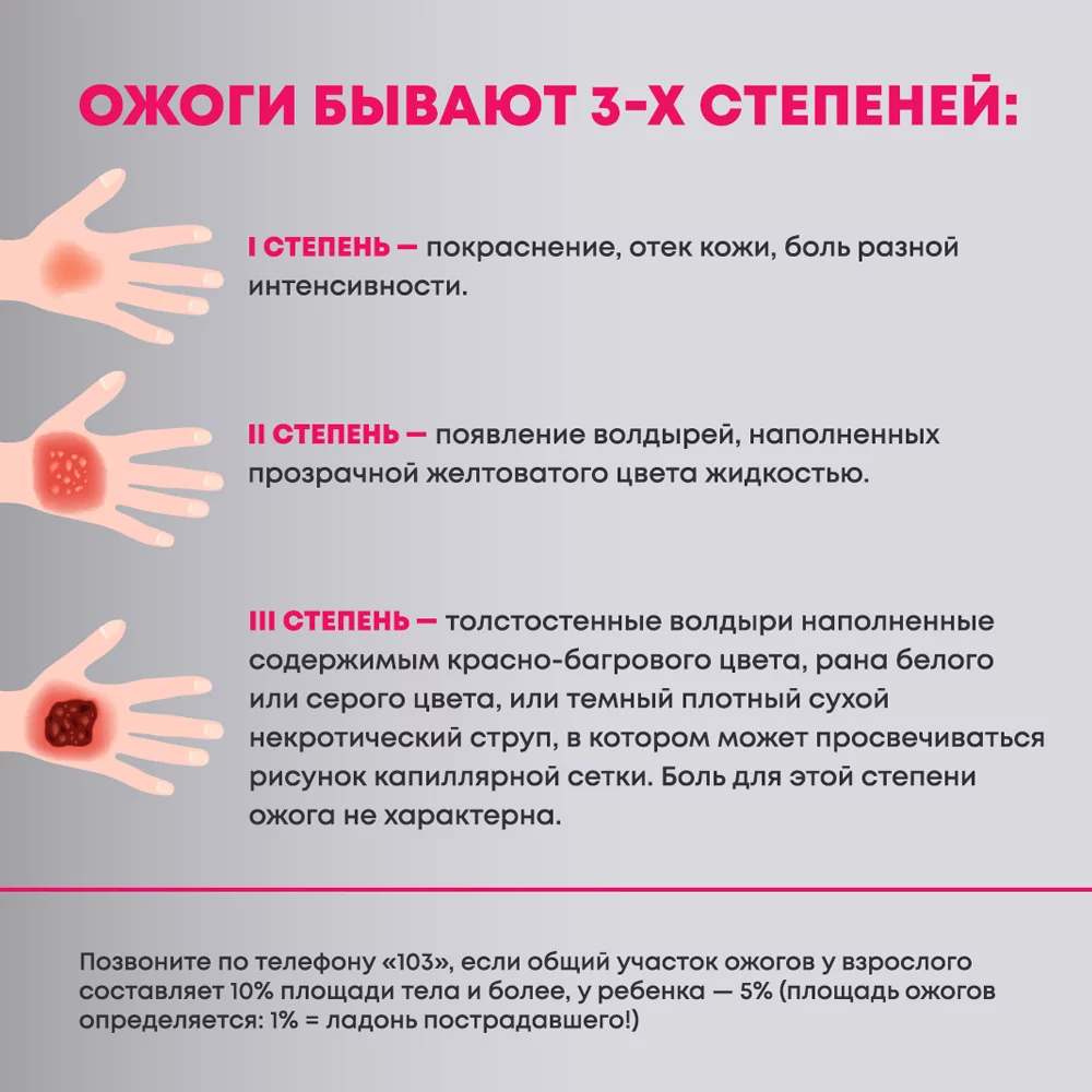 Что такое ожоги и каких степеней они бывают?