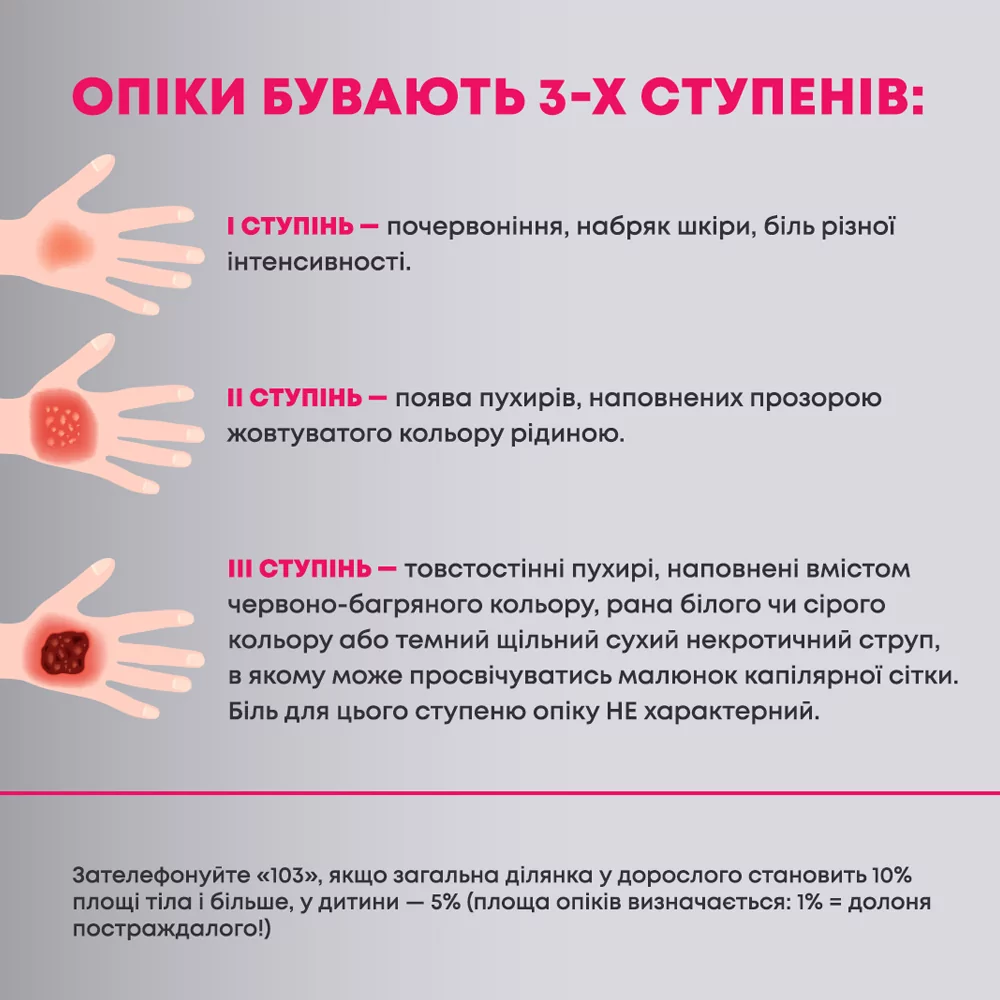 Що таке опіки і які є їх ступені?