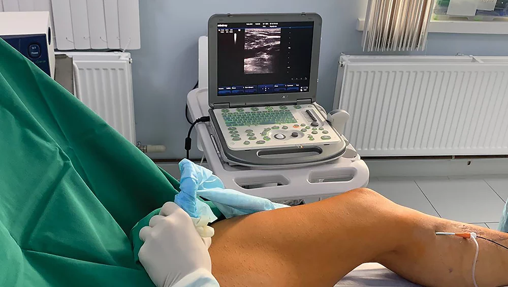 How to preserve the health of veins for many years?