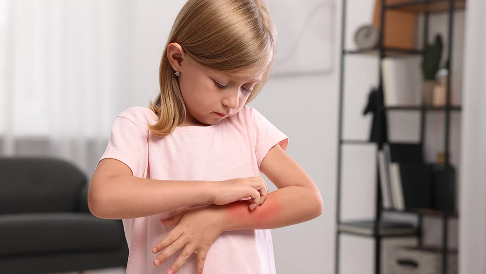 Main Children's Skin Diseases: The most important