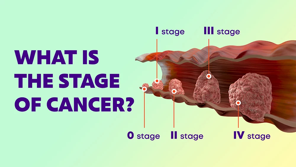 OncoProsvita