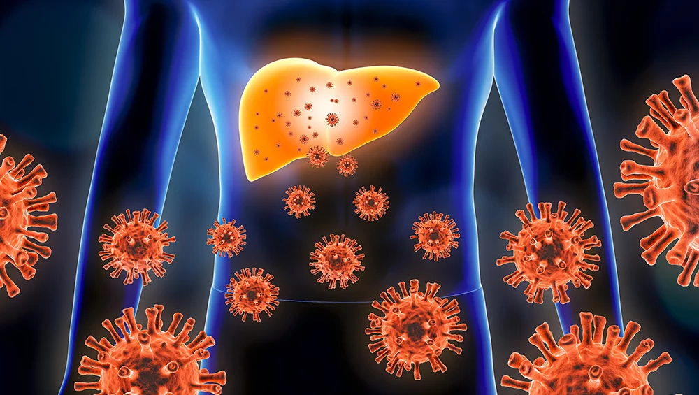 Hepatitis A: What you need to know about symptoms and treatment