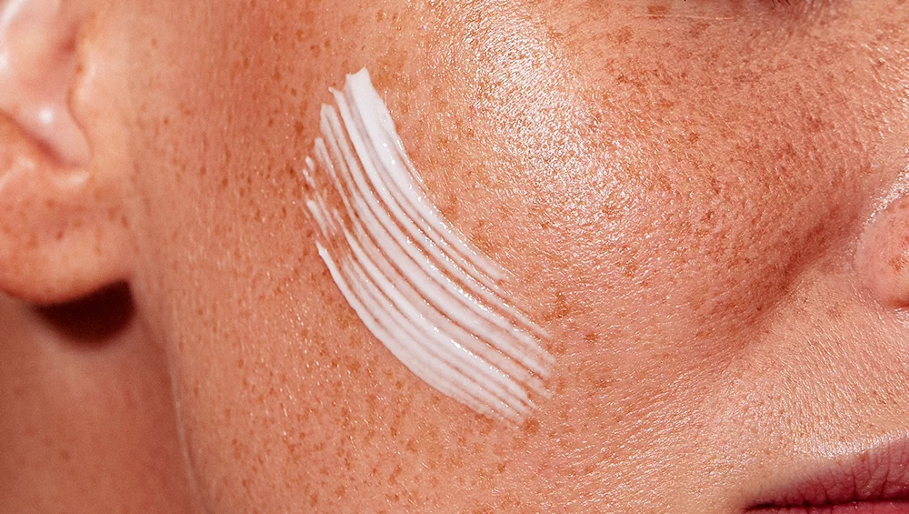 Laser or peeling: what to choose to combat pigmentation