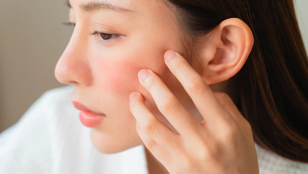 — How to understand that the skin is really sensitive and not reacting to an allergy or a dermatological problem that has started?