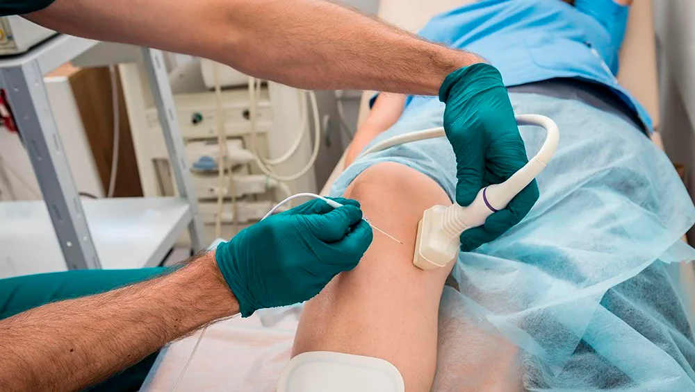 Radiofrequency Ablation in Various Types of Cancer: Modern Indications