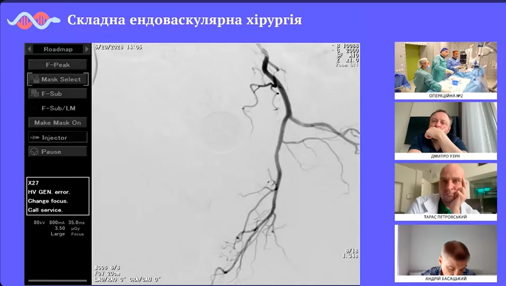 Яку роль відіграє ендоваскулярний хірург