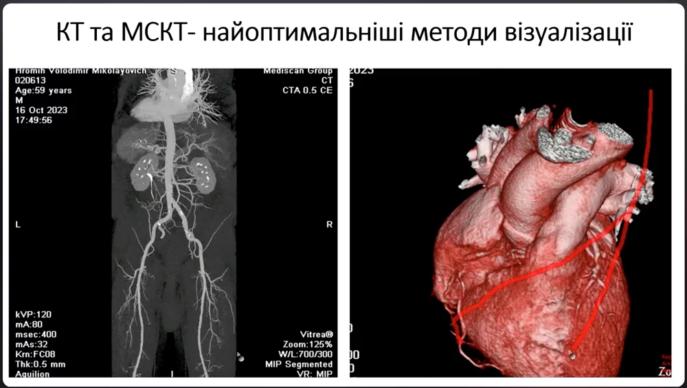 Диагностика и лечение заболеваний сердца как основа успешной операции